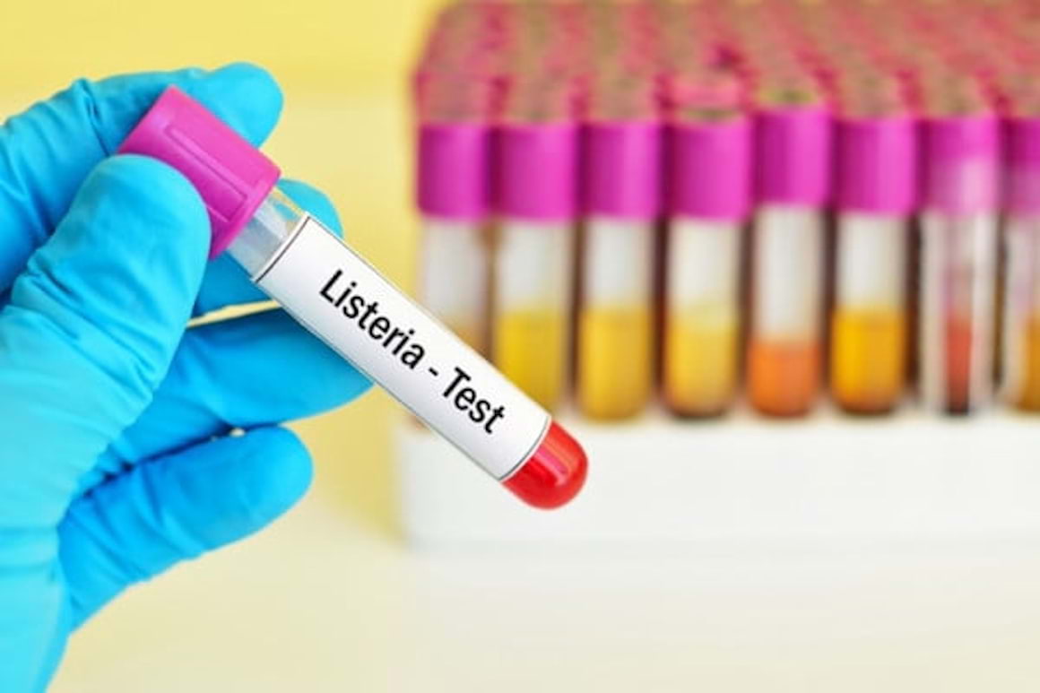 Listerioza (infectia cauzata de bacteria listeria), pericol pentru gravide