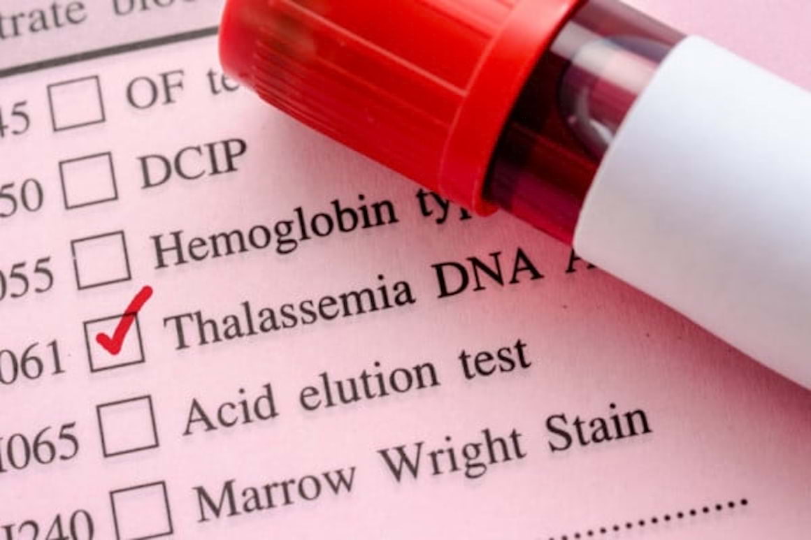 Talasemia: tipuri, cauze, simptome si tratament