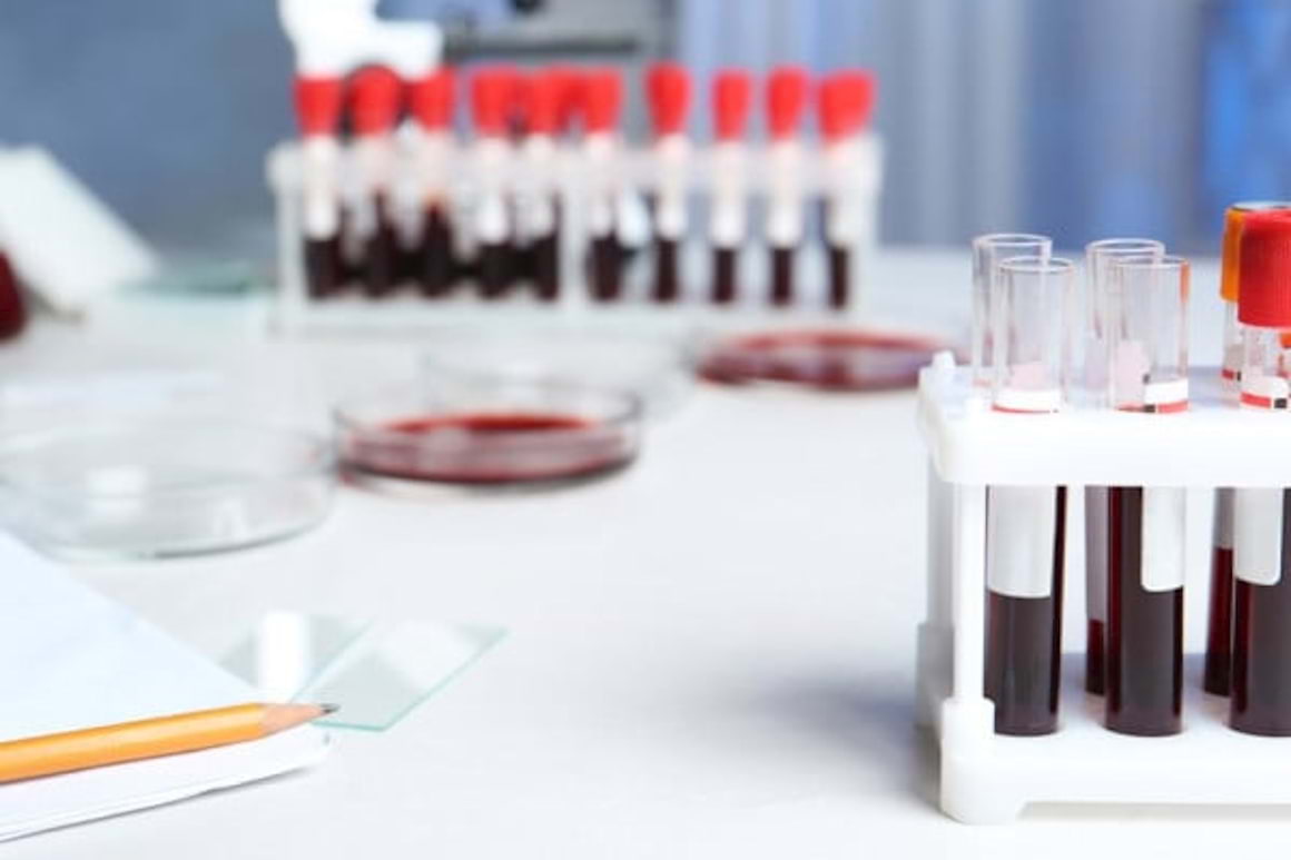 De ce e importanta testarea genetica la persoanele cu profil lipidic problematic