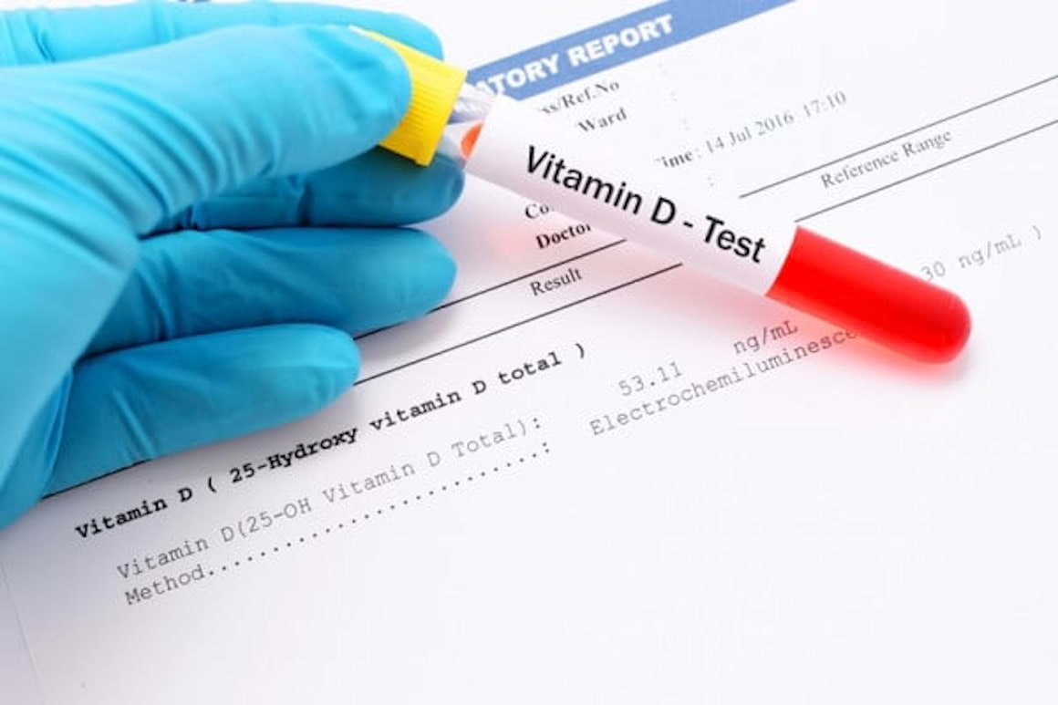 Vitamina D reduce activitatea colitei ulcerative?