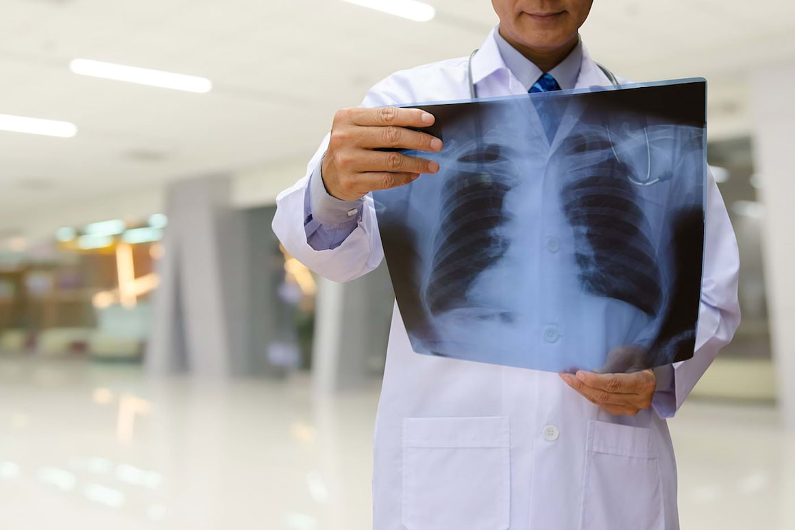Speranțe noi în tratarea fibrozei pulmonare asociată cu senectutea [studiu]