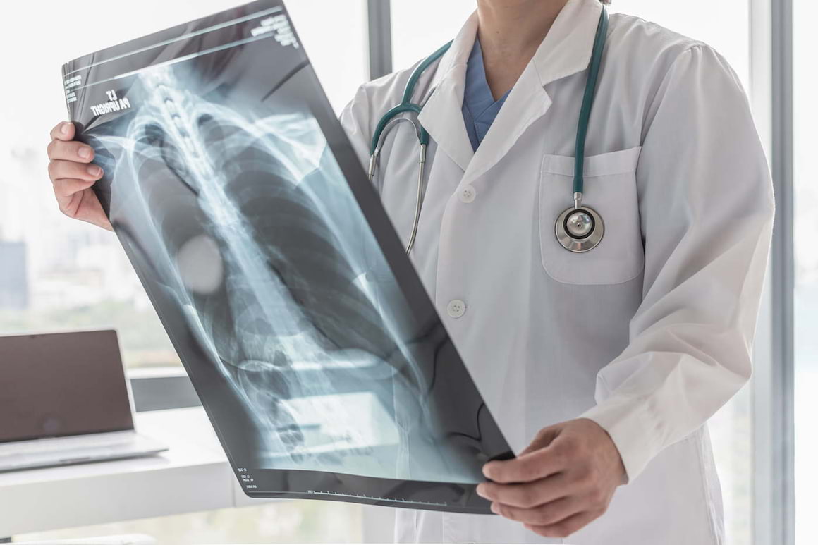 Cum influențează infecția cu SARS-CoV-2 boala pulmonară obstructivă cronică