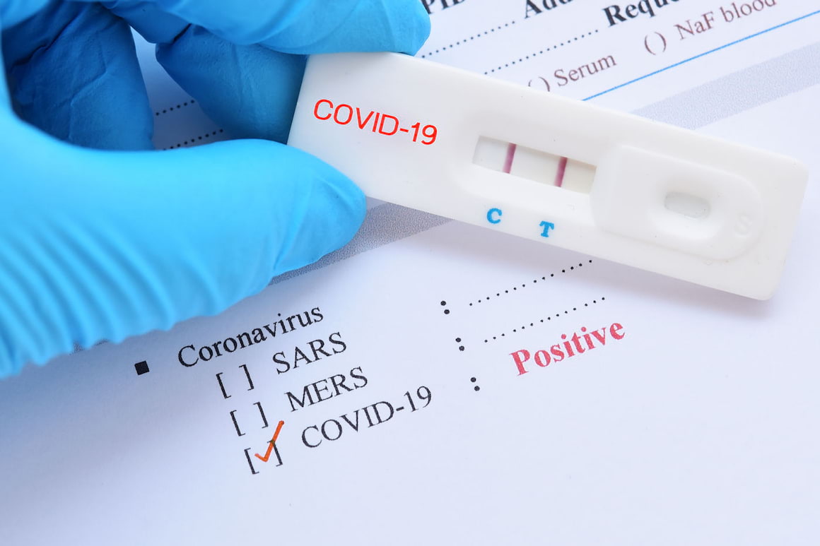 COVID-19: Importanța determinării anticorpilor de tip IgM și IgG anti-SARS-CoV-2
