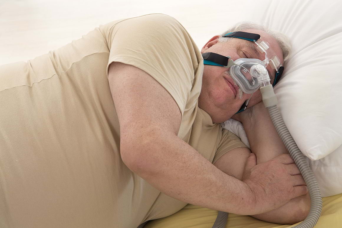 Obezitatea, factor de risc pentru persoanele infectate cu SARS-CoV-2
