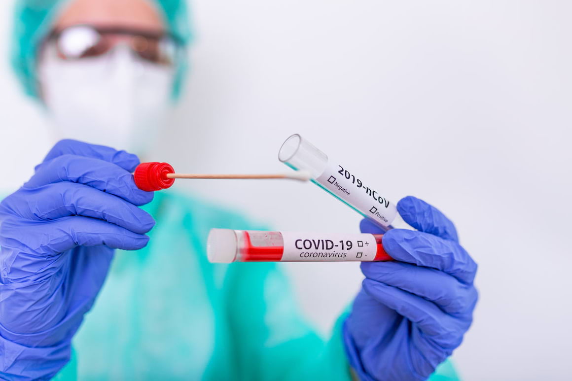 Este necesară retestarea după 14 zile de la infecția cu SARS-CoV-2?