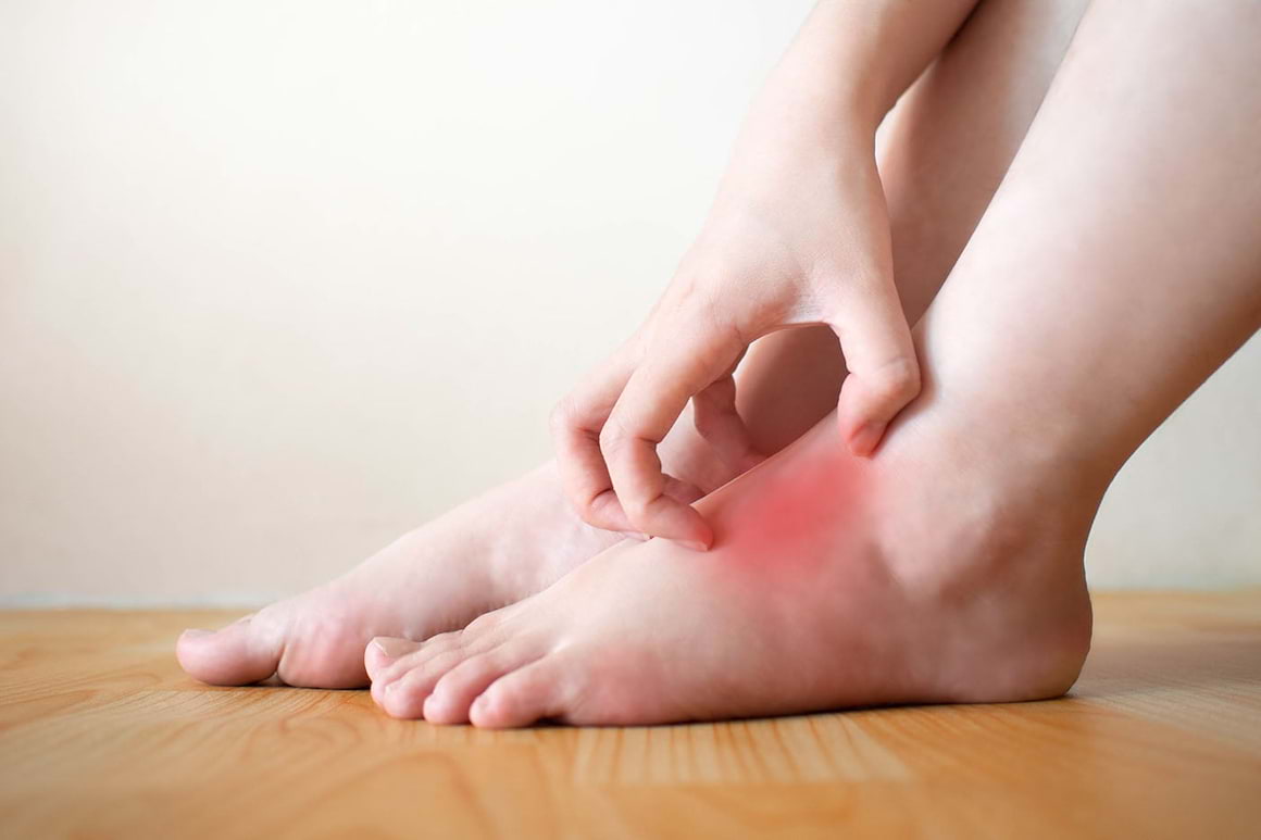 Ai mereu mâinile și picioarele fierbinți? 10 cauze posibile