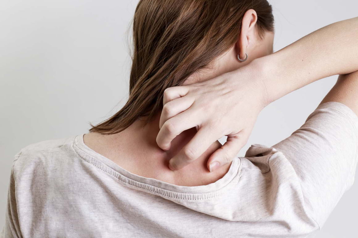 Tipuri de psoriazis și forme de tratament