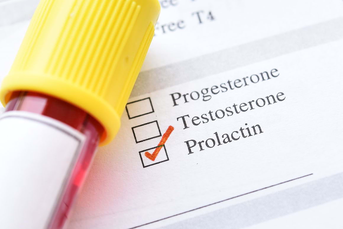 Prolactina și cancerul de sân: cum sunt conectate?