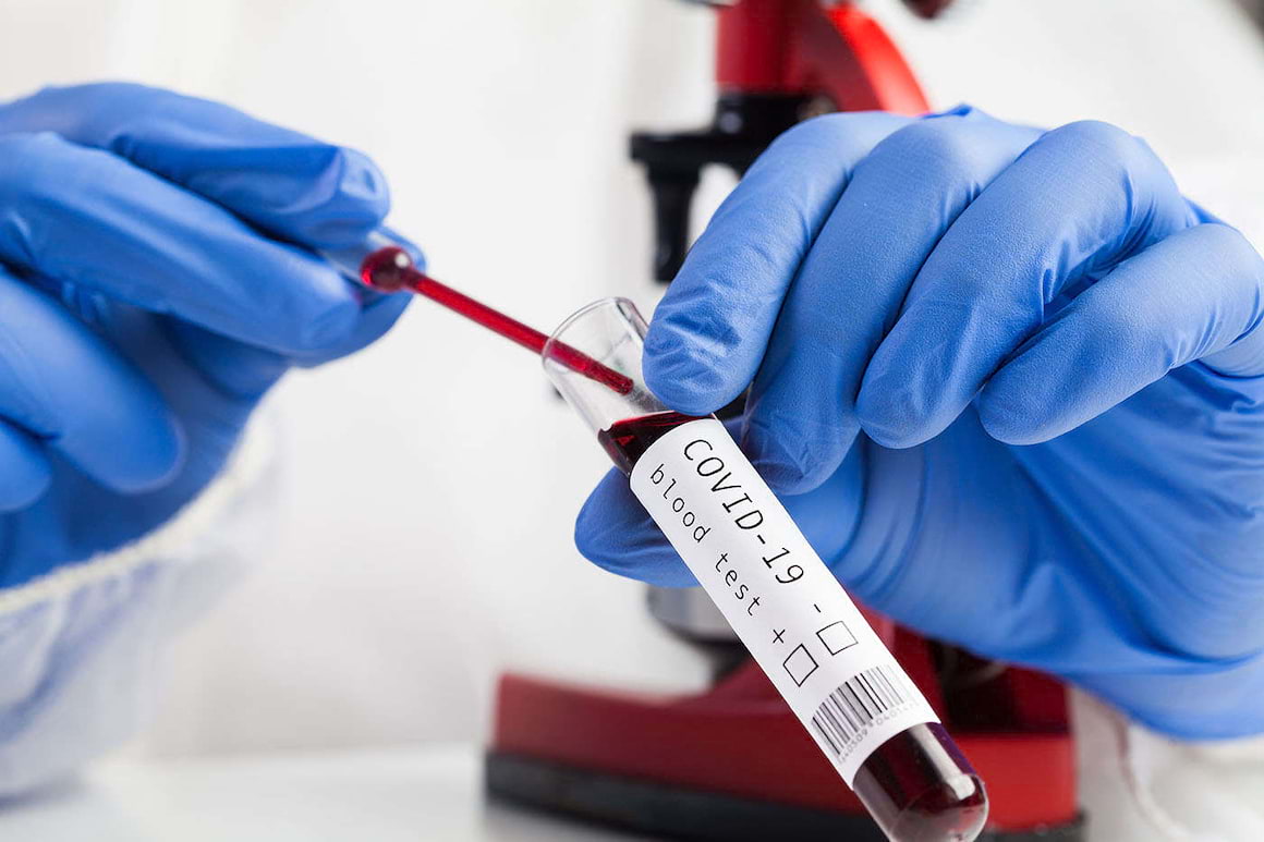 COVID-19 în formă gravă, frecvent asociat cu sindrom inflamator intens manifest și hiperferitinemie