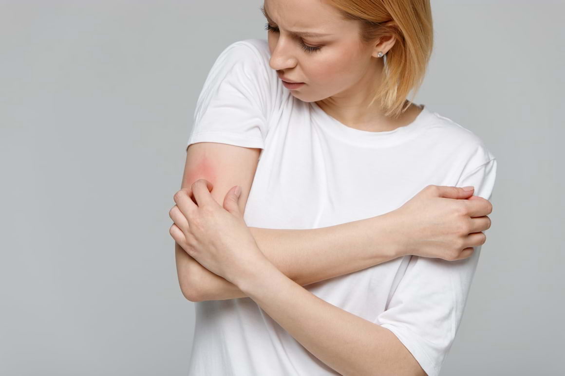 Dermatografismul sau urticaria dermatografică: simptome, cauze, tratament