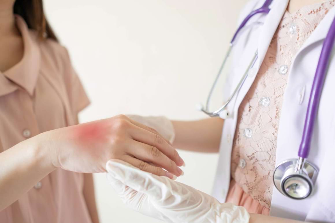 10 tipuri de iritații care apar în colita ulcerativă