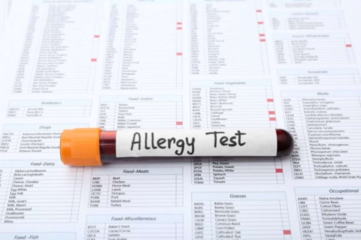 Un nou test de sange ar putea depista alergia la arahide fara riscuri [studiu]