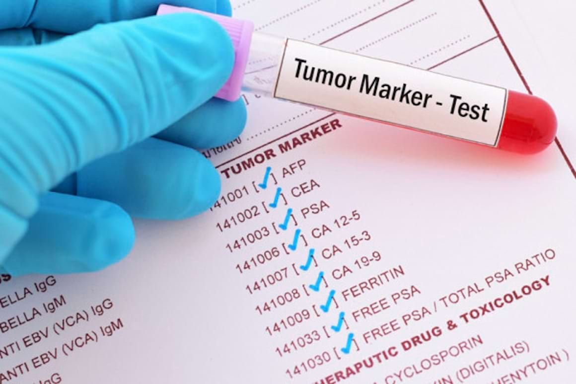 Biomarkeri și terapia target în tratarea cancerului