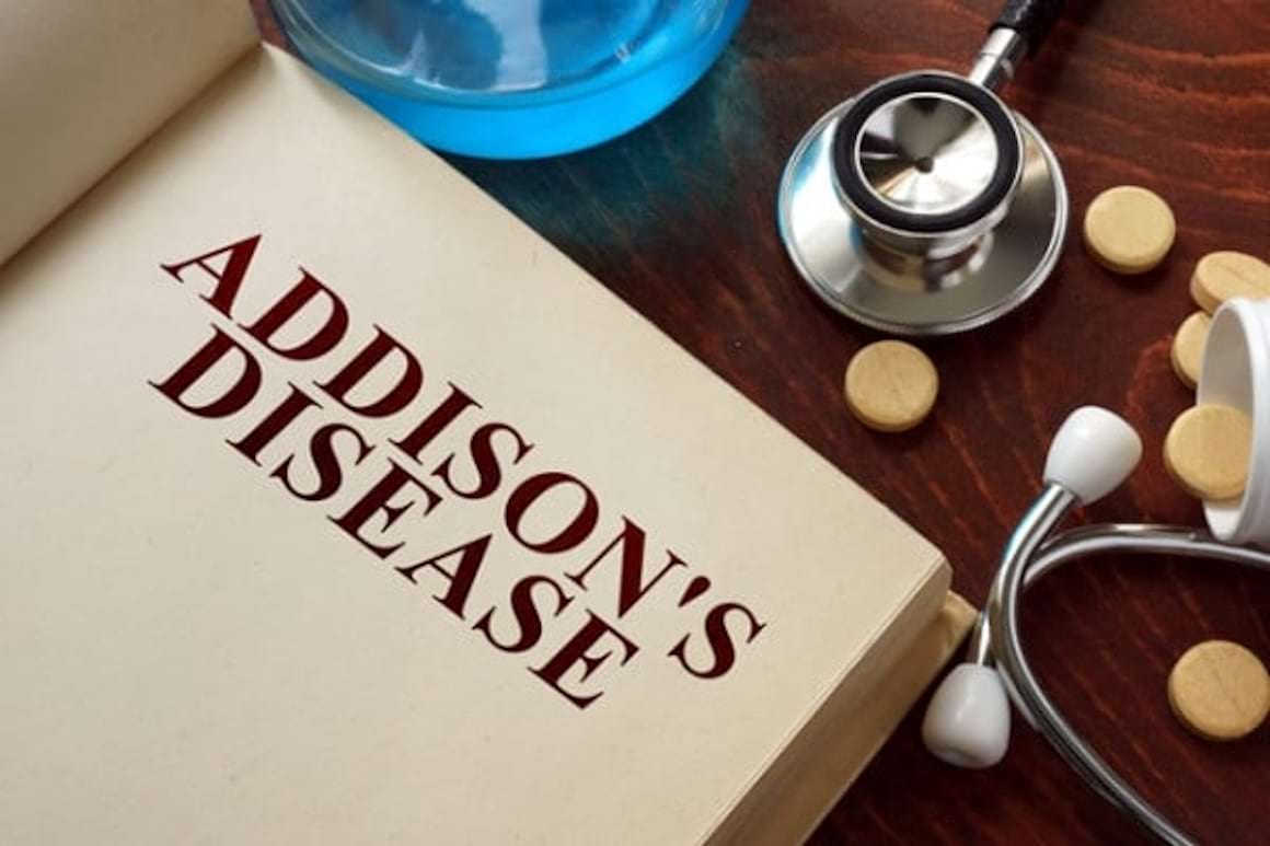 Boala Addison: cauze, simptome si tratament