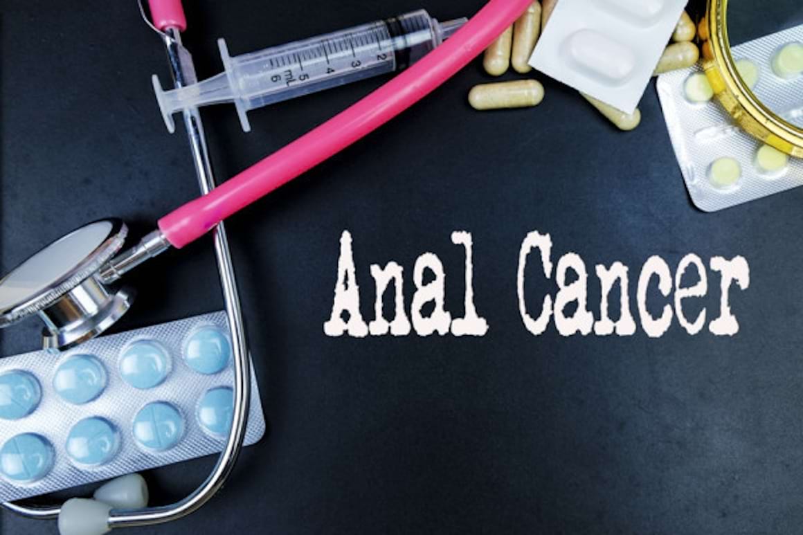 Cancerul anal: factori de risc, clasificare, simptome & tratament