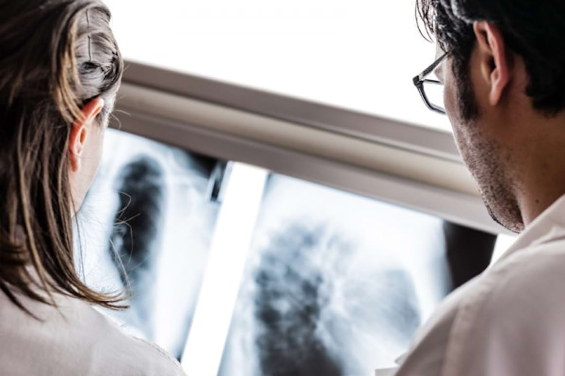 Cancerul pulmonar metastatic – cum apare si cum poate fi gestionat diagnosticul