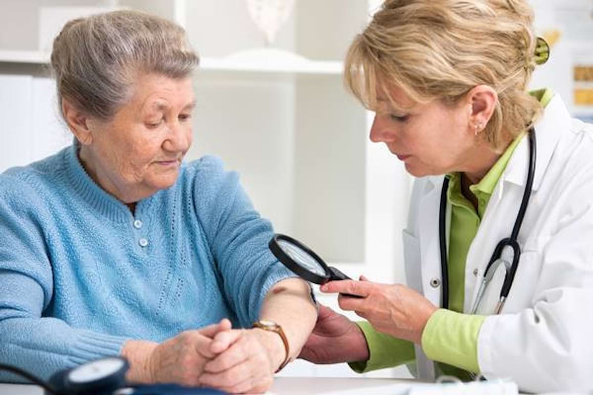 Diagnosticul melanomului - cum se stabileste