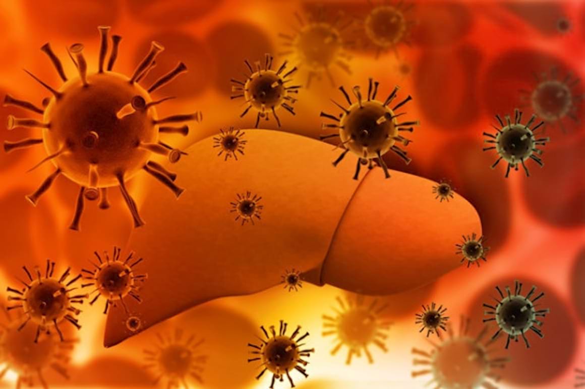 Factorii care accelereaza evolutia hepatitei cronice cu virusul hepatitei C spre ciroza