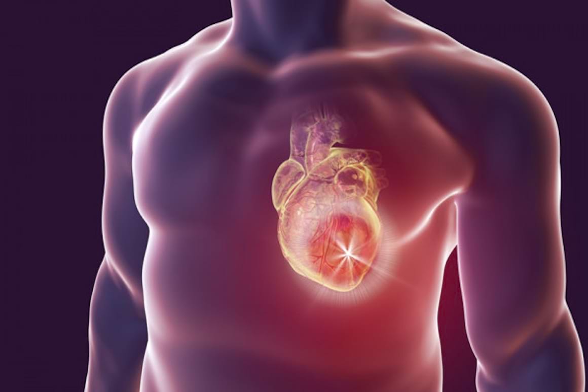 Cum poti reduce factorii de risc asociati cu infarctul miocardic
