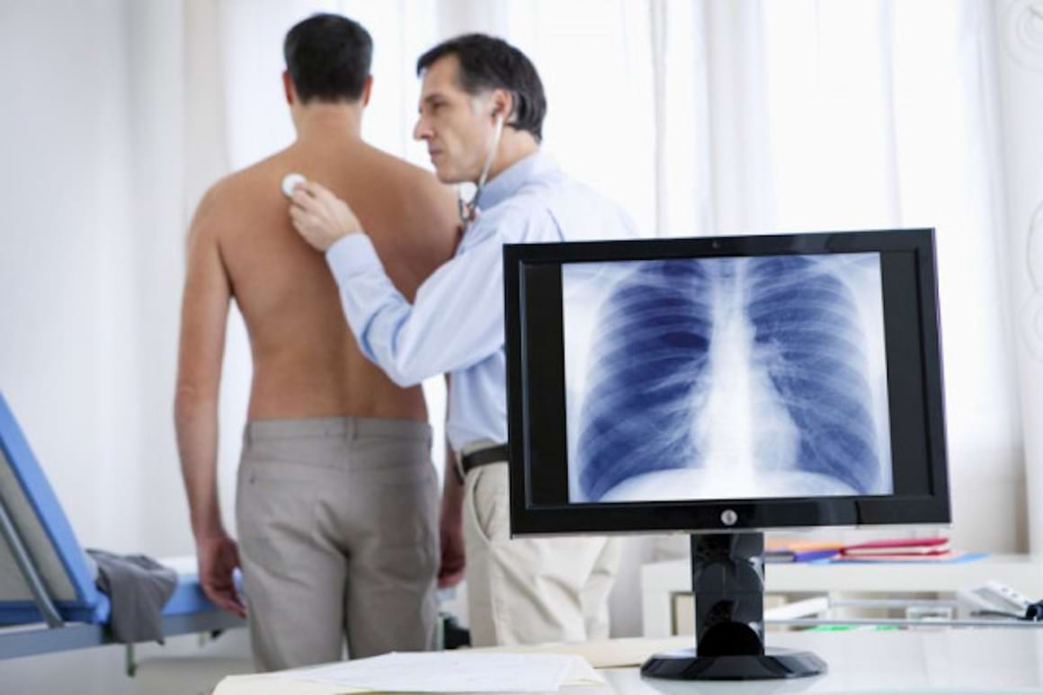 Istoricul de boli respiratorii - indicator pentru cancerul pulmonar?