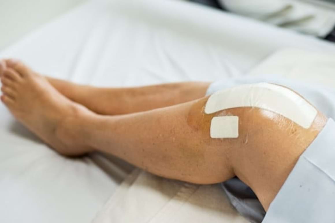 Afectarea ligamentelor genunchiului: Ligamentoplastia, printre cele mai bune tehnici de reconstructie