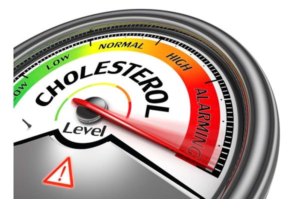 Colesterol mare: ce e de facut?