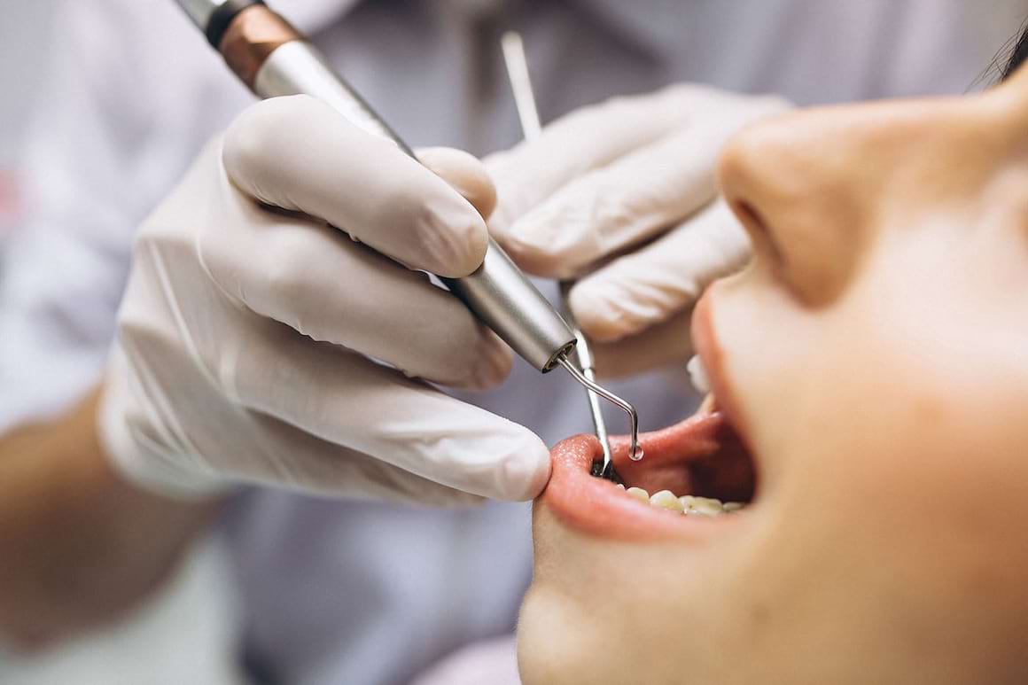 Anestezia dentară - tipuri, avantaje, riscuri, contraindicații