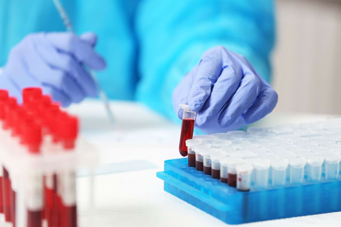 Cancerul, depistat cu 4 ani înainte de apariția simptomelor? [studiu]