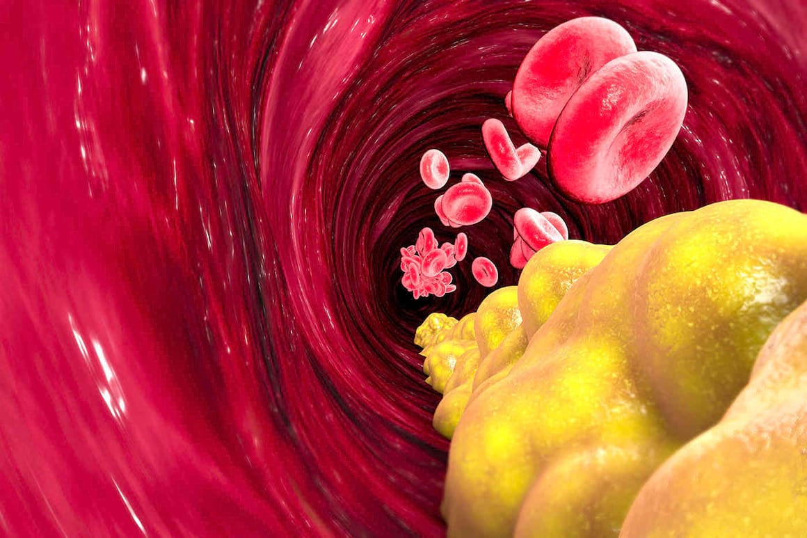 Ce impact are colesterolul asupra membranelor celulare [studiu]
