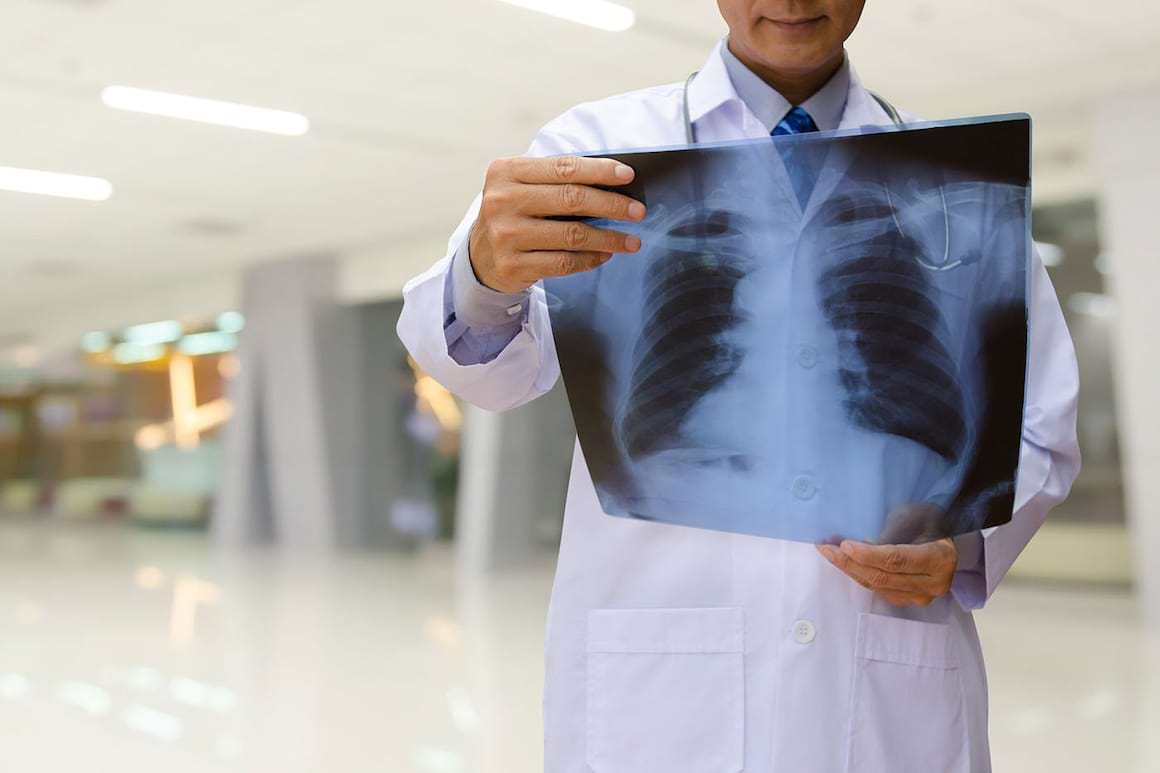 Speranțe noi în tratarea fibrozei pulmonare asociată cu senectutea [studiu]
