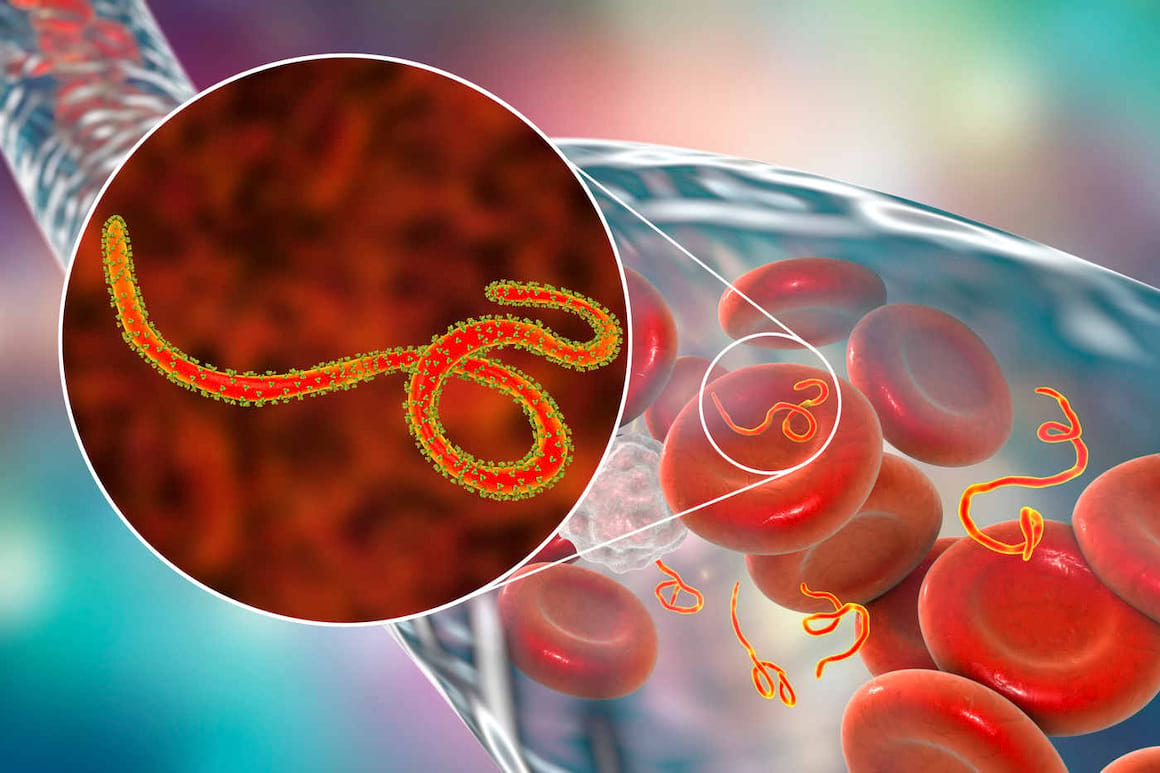 Ce ar trebui să știi despre Ebola