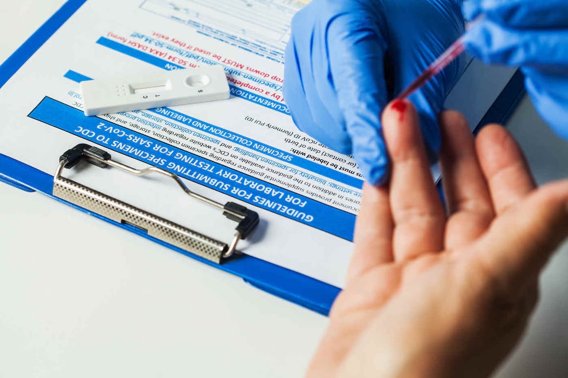 Ce rol au testele serologice validate de CDC în pandemia COVID-19?