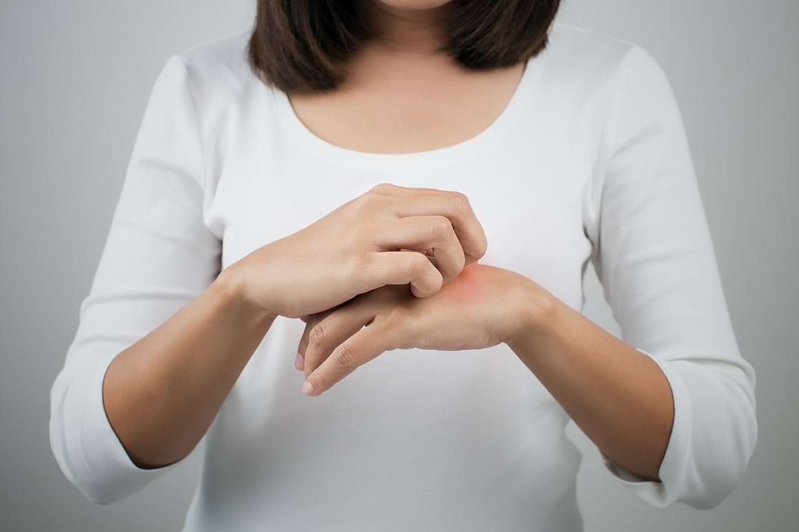 Dermatita atopică (eczema): cauze, simptome, tratament