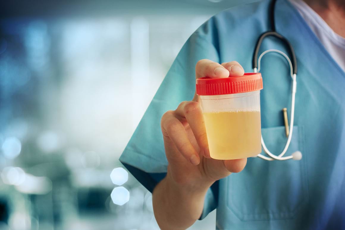 Cancerul de vezică urinară ar putea fi detectat mai ușor (studiu)
