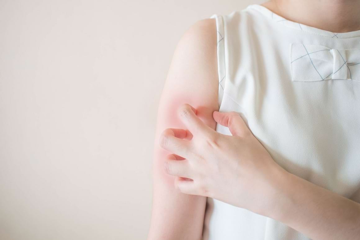 Lipsa mișcării predispune la psoriazis? [studiu]