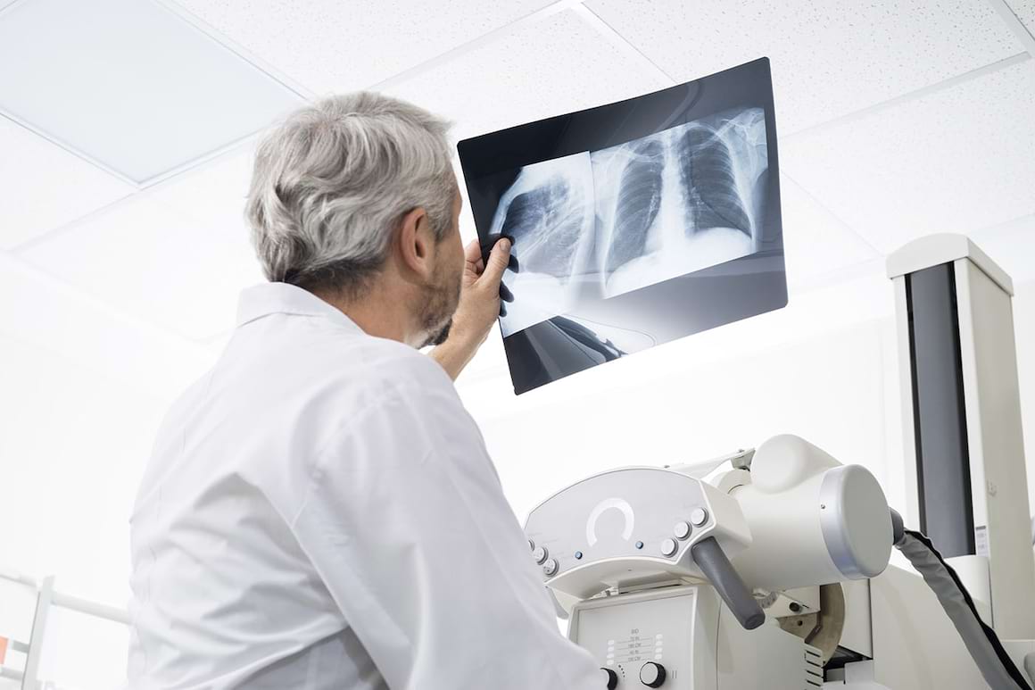 Diabetul și poluarea, corelate cu riscul de boală pulmonară interstițială [studiu]