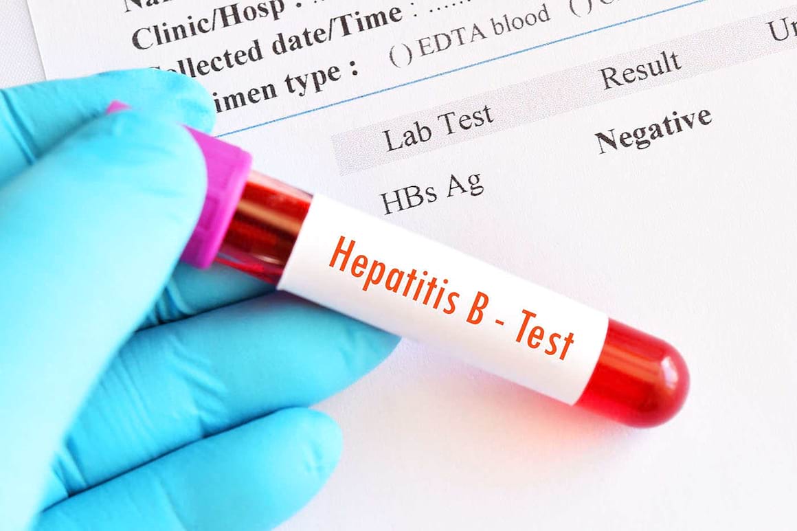 Tratamentul hepatitei B: speranțe pentru un tip de imunoterapie