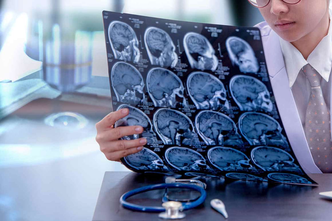 Leziunile cerebrale cauzate de AVC ar putea fi reparate cu celule stem?