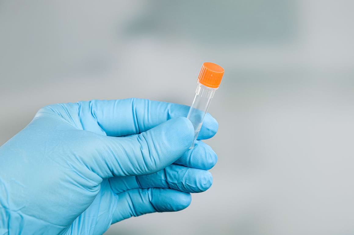 Disruptorii endocrini afectează calitatea lichidului seminal [studiu]