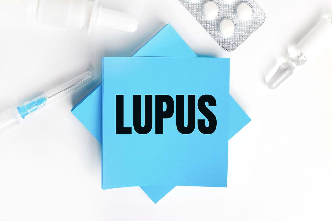 Carența de vitamina D modifică metabolismul pacienților cu lupus [studiu]