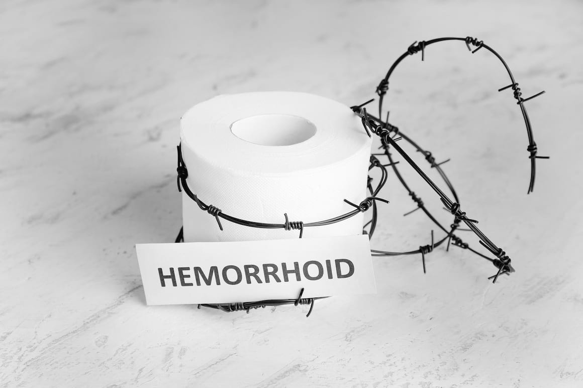 Hemoroizii: cauze, simptome si tratament