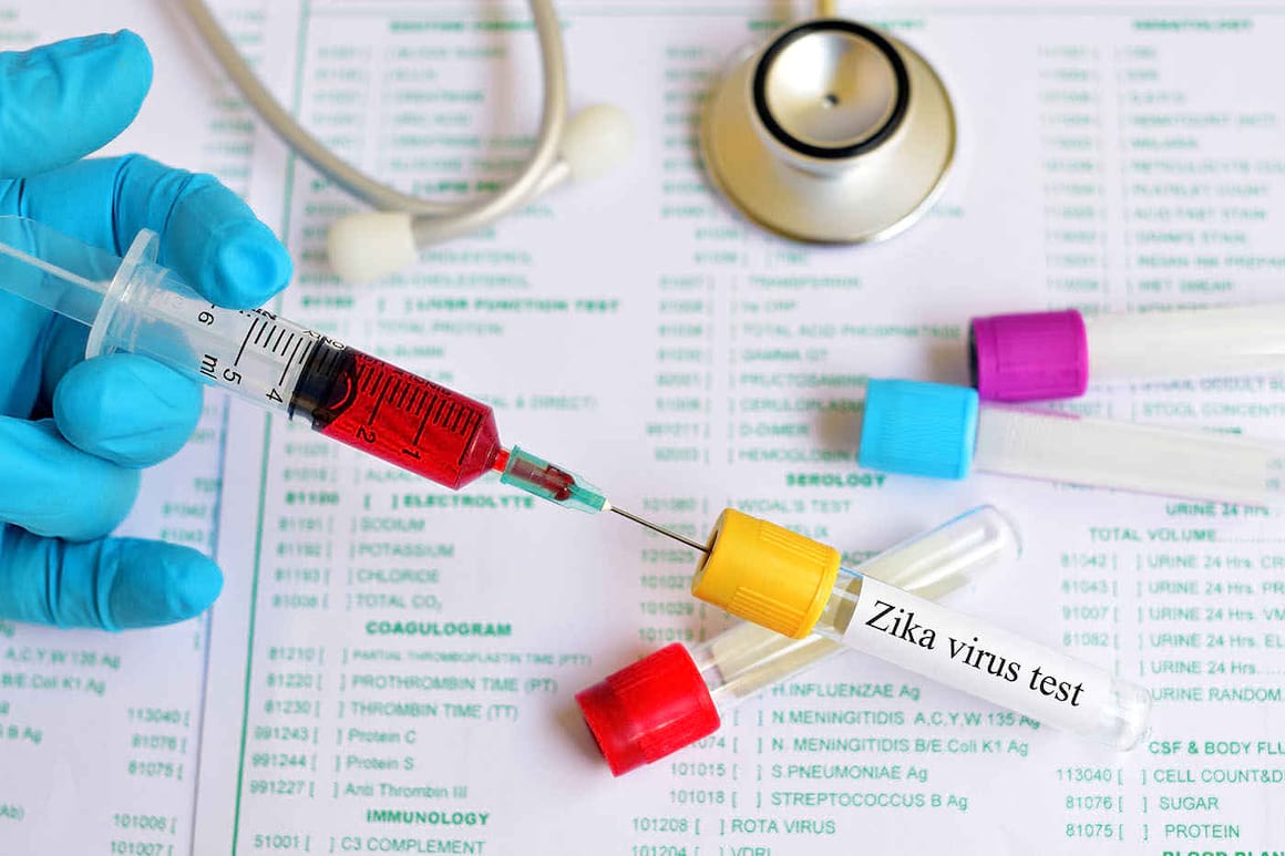 Virusul Zika inhibă proliferarea cancerului de prostată? [studiu]