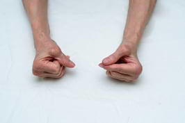 artrita reumatoida imagini artroza genunchiului 2 grade cum se tratează