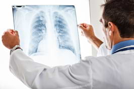 Infectiile pulmonare la pacientul cu cancer