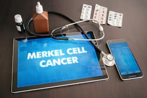 Carcinomul cu celule Merkel, un cancer cutanat rar dar agresiv