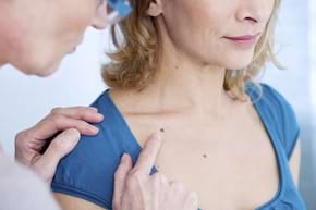 Gena &rdquo;de protectie solara&rdquo; va poate proteja impotriva cancerului de piele