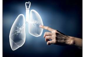 Inteligenta artificiala, folosita pentru diagnosticarea cancerului pulmonar