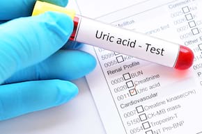 Acidul uric joacă un rol important &icirc;n sindromul metabolic [studiu]