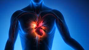 Infarct: semne prevestitoare si tot ce este esential sa stii