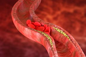 Ateroscleroza, prevenită cu ajutorul unor peptide? [studiu]